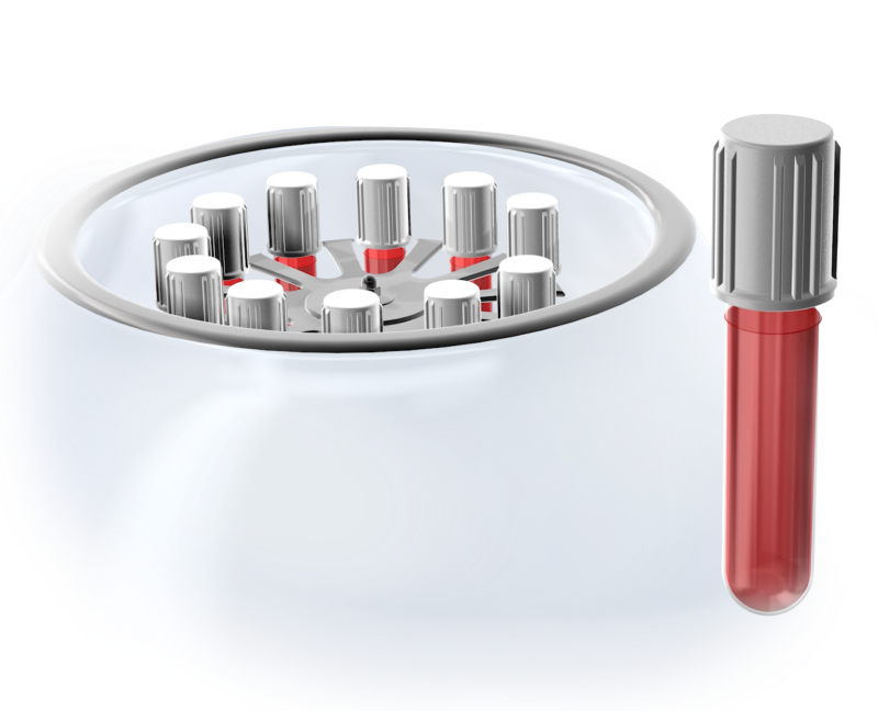 Isolated  prp fibrin  mobile