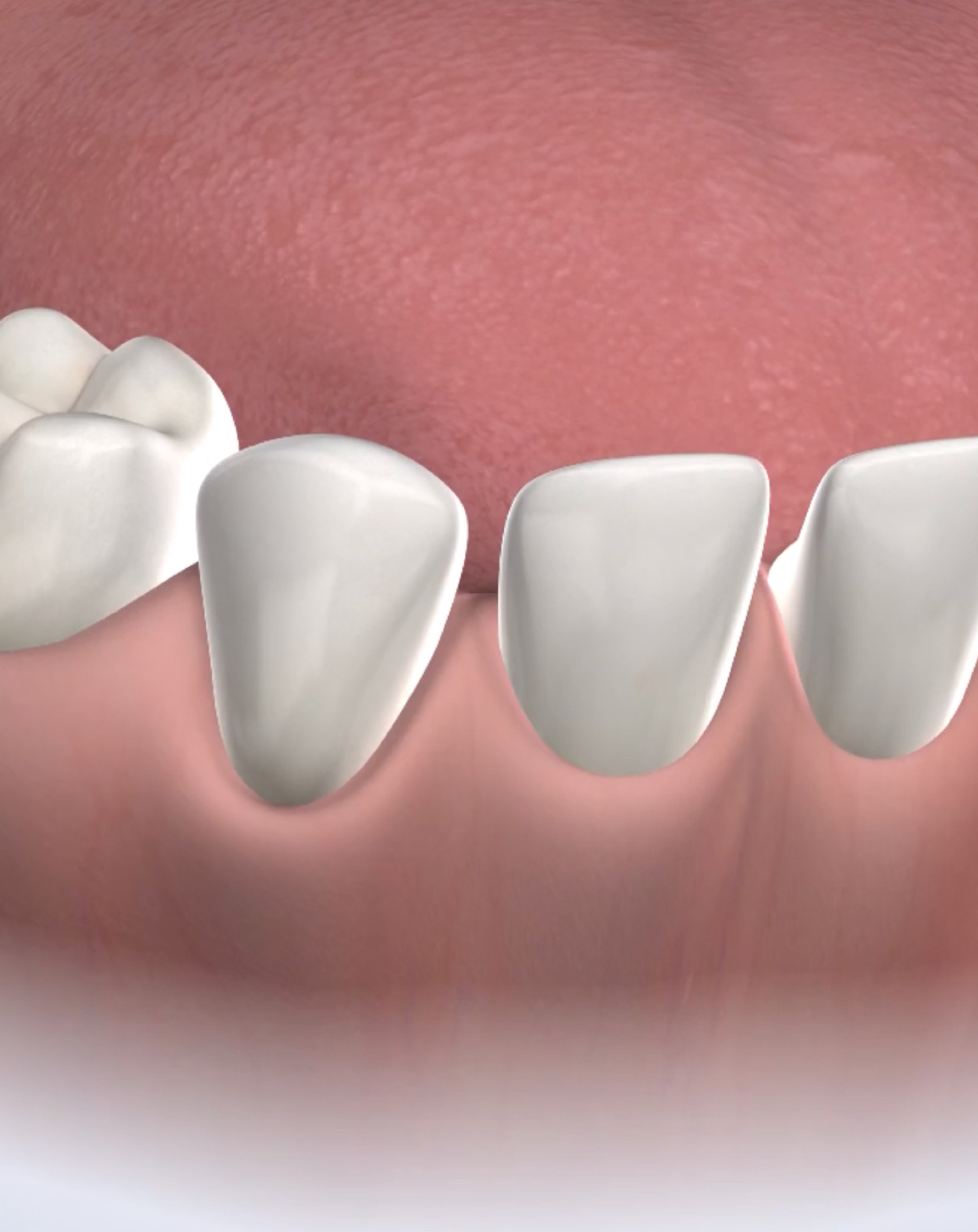 Pediatric Oral Surgery