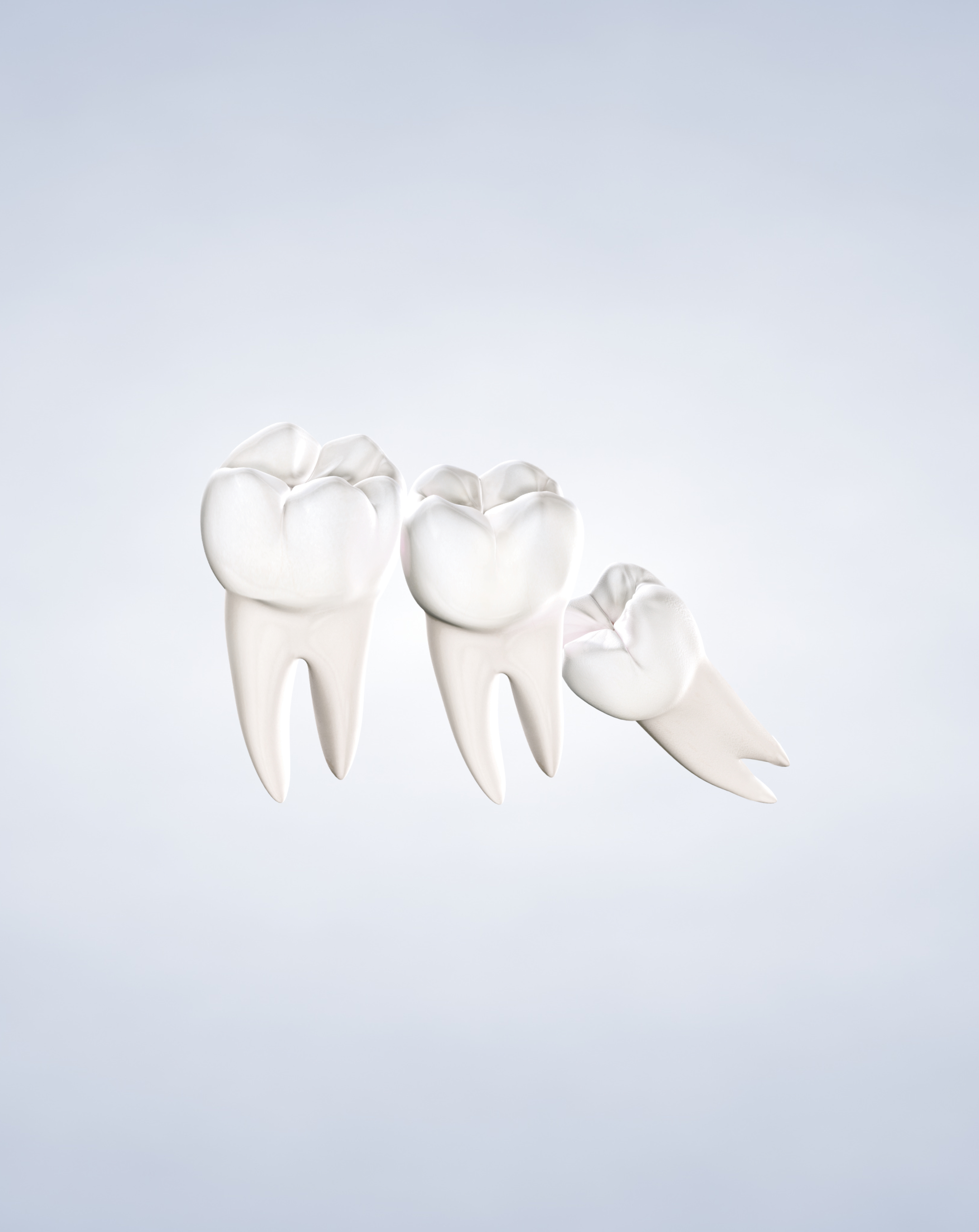 Wisdom Teeth Removal What To Expect