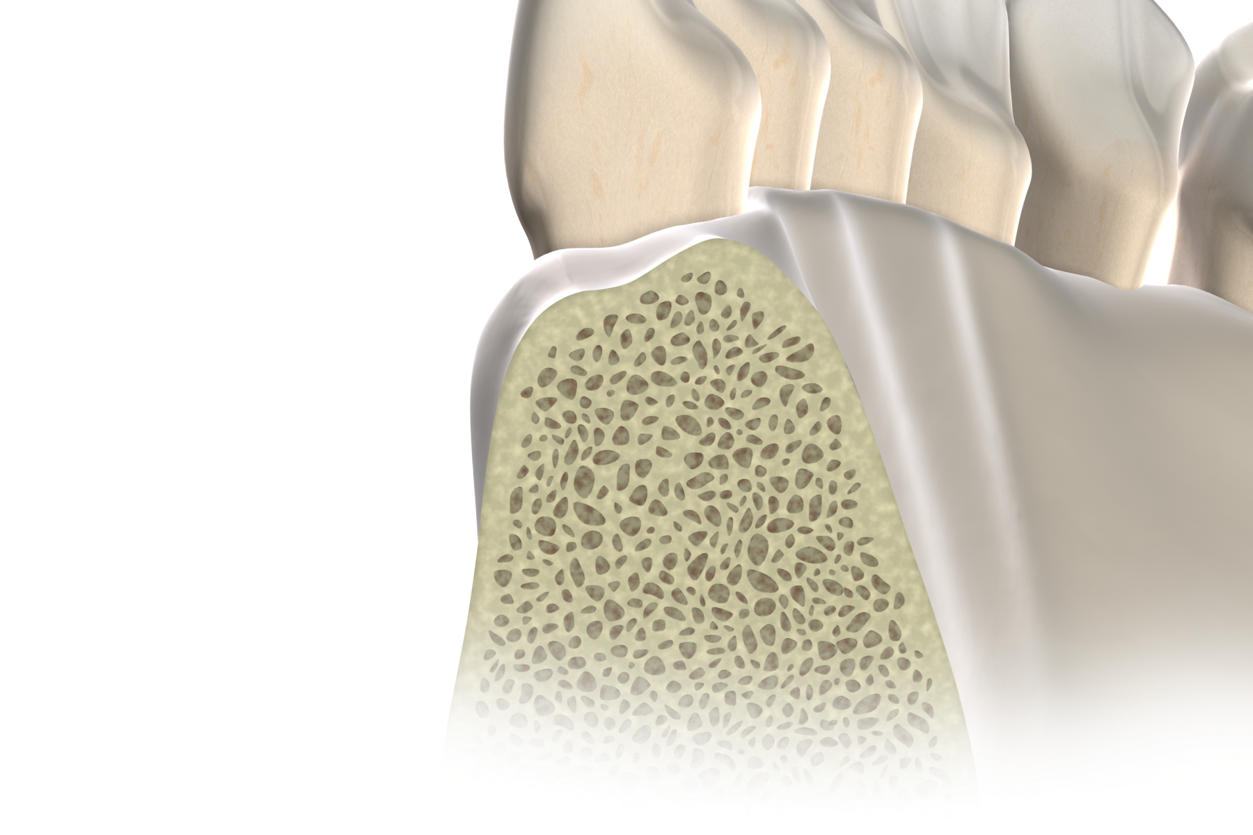Isolated  apicoectomy