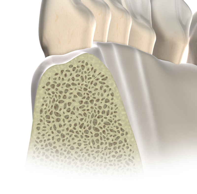 Isolated  apicoectomy  mobile