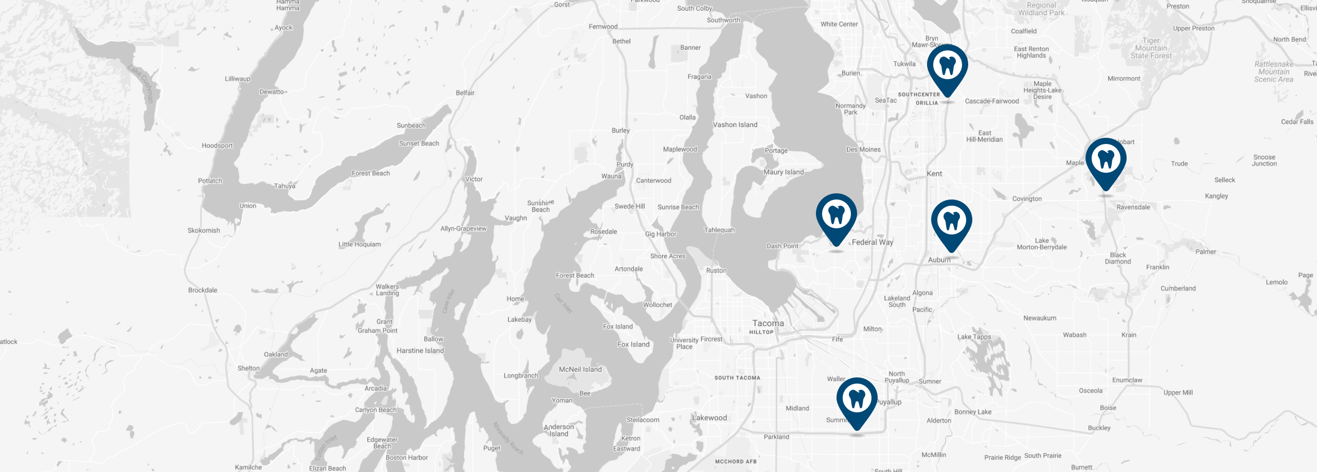 Oral Surgery in Auburn, Federal Way, Renton, Maple Valley, Puyallup, WA