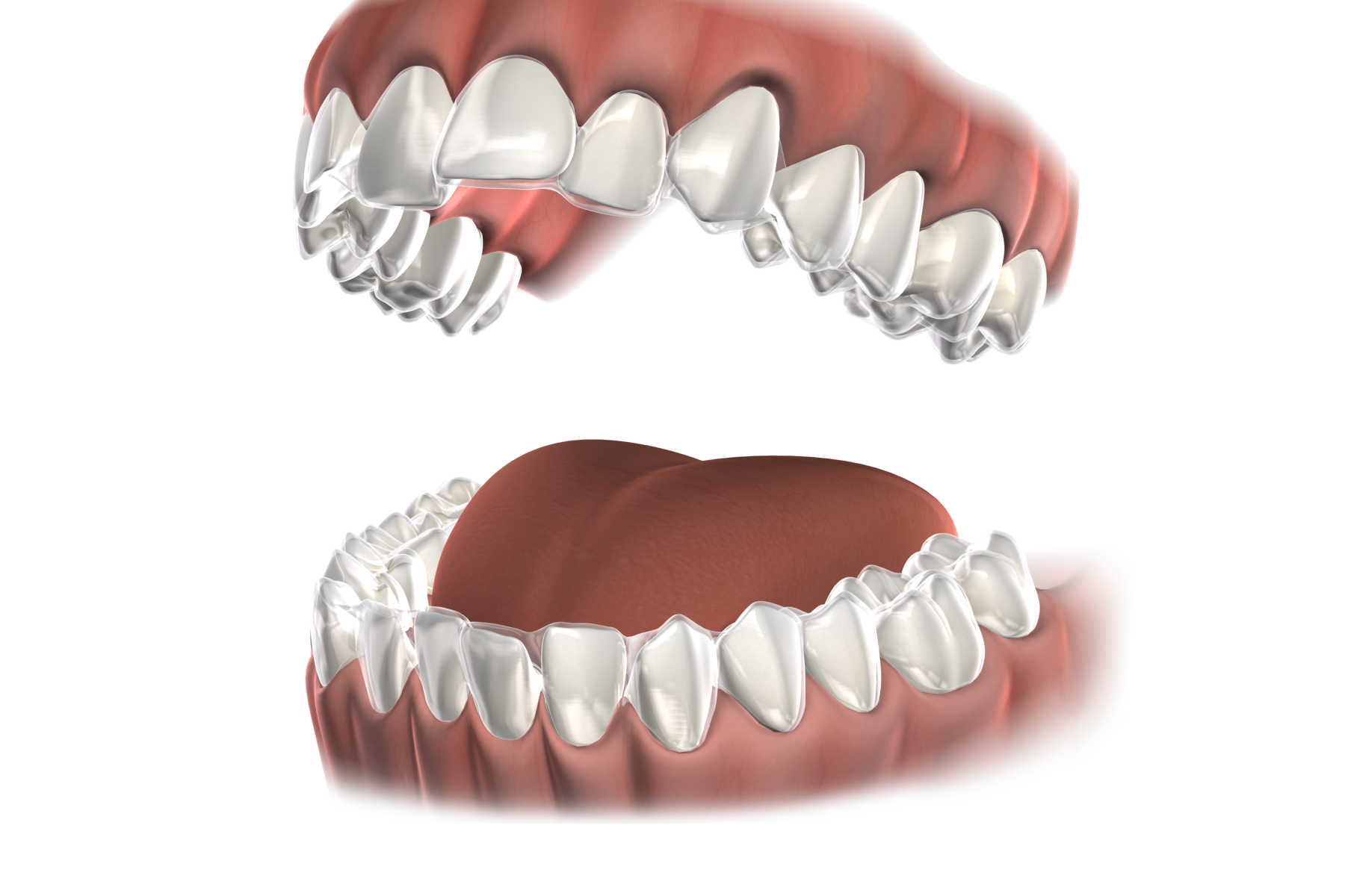 Isolated  aligner
