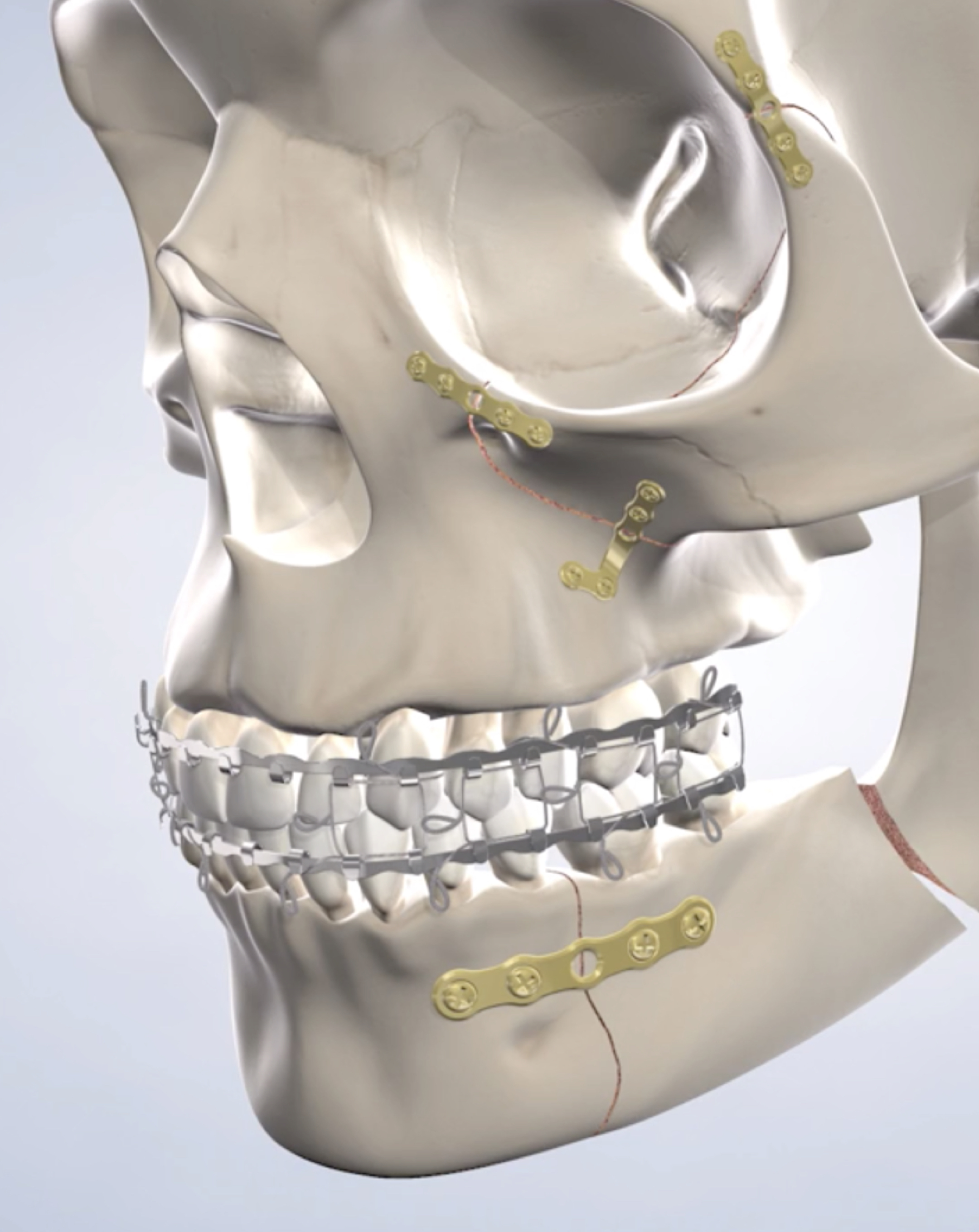 Procedure hero mobile facial trauma.jpg