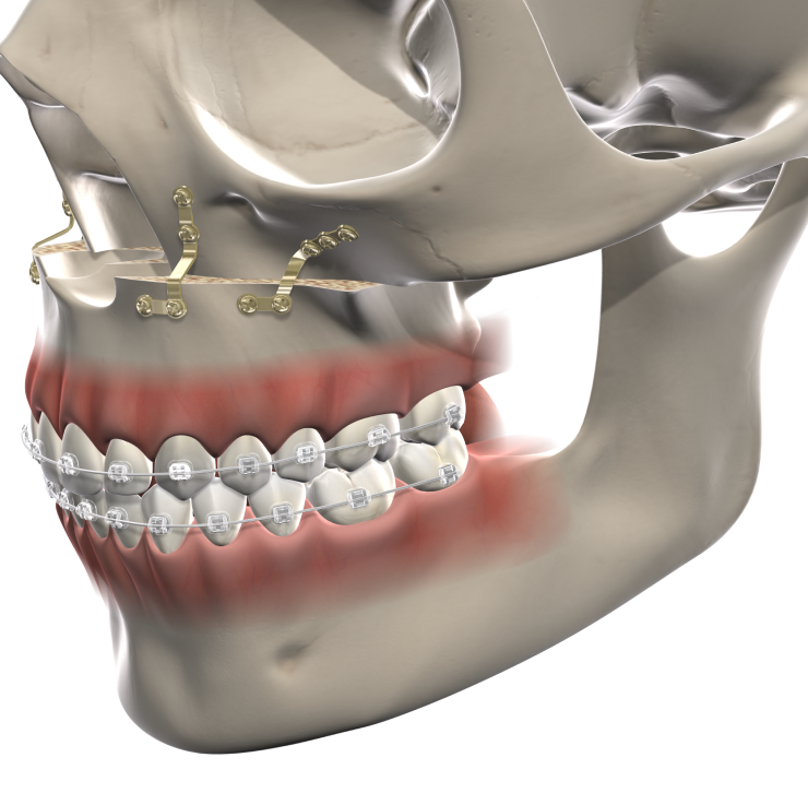 Hero images Utah Surgical Arts Facial TraumaFacial Trauma Mobile