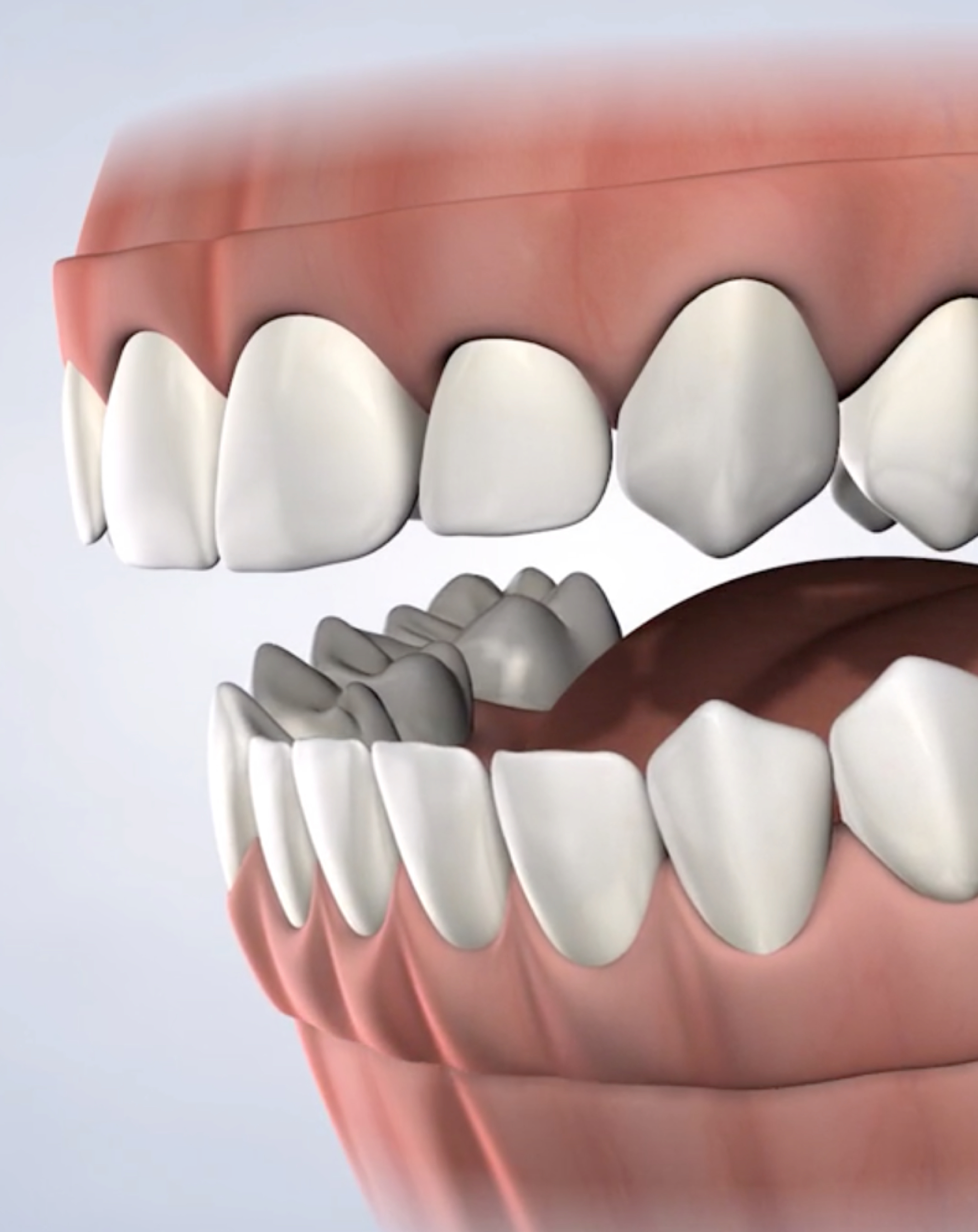 Pre-prosthetic surgery in South Jordan, Provo, Payson, and Lehi, Utah