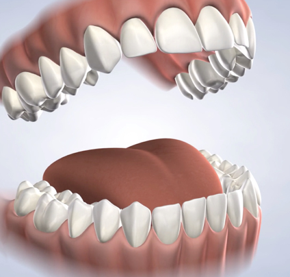 Dental checkups in Lehi, UT