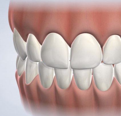 Dental cleanings in Lehi, UT