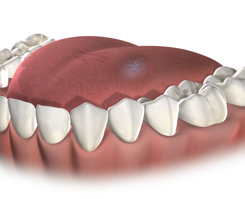 isolated  oral pathology  mobile