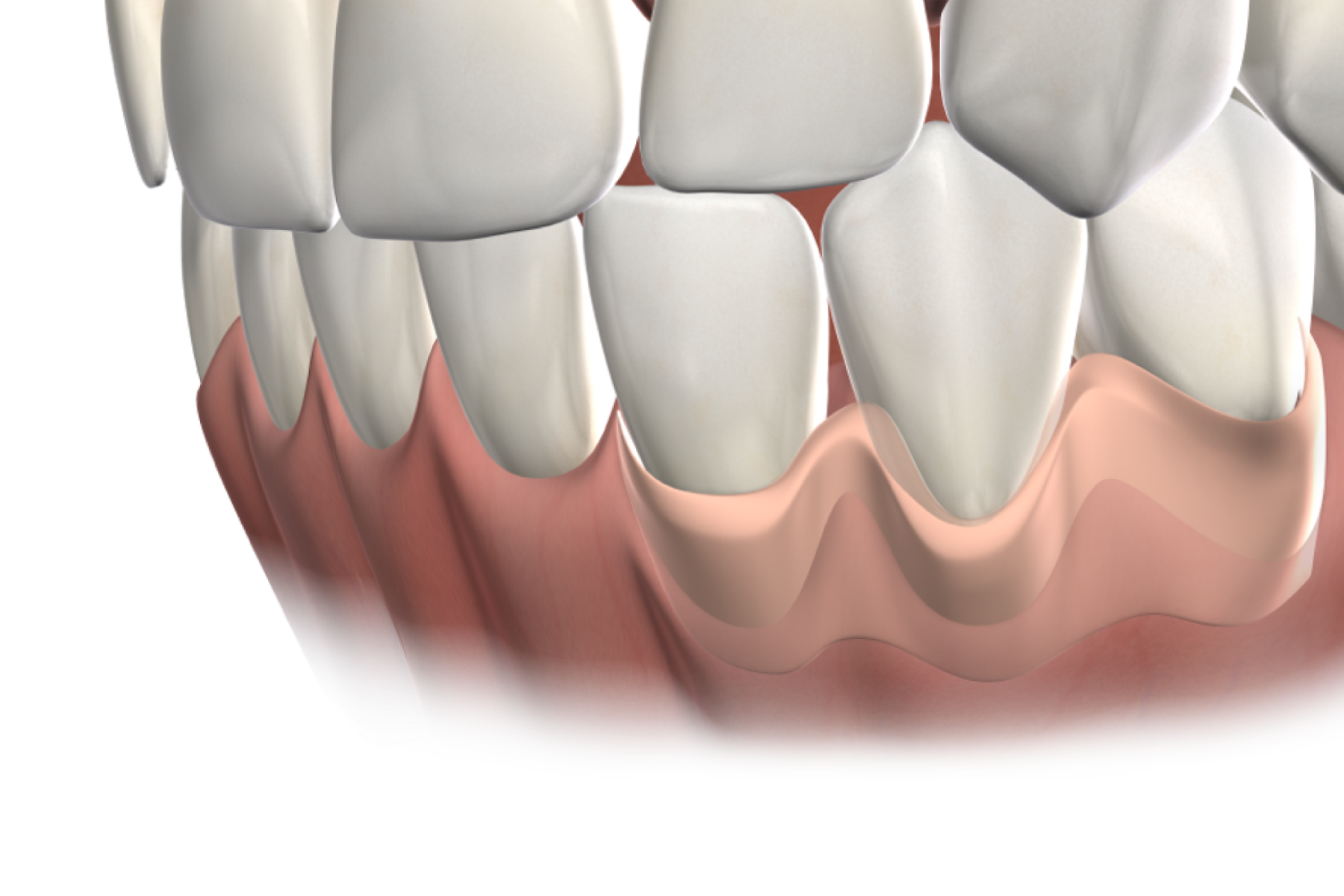 Gum grafting banner desktop