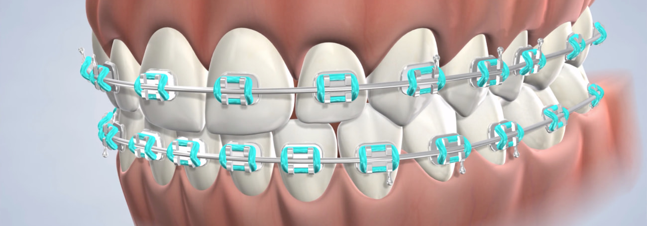 Braces care procedure desktop