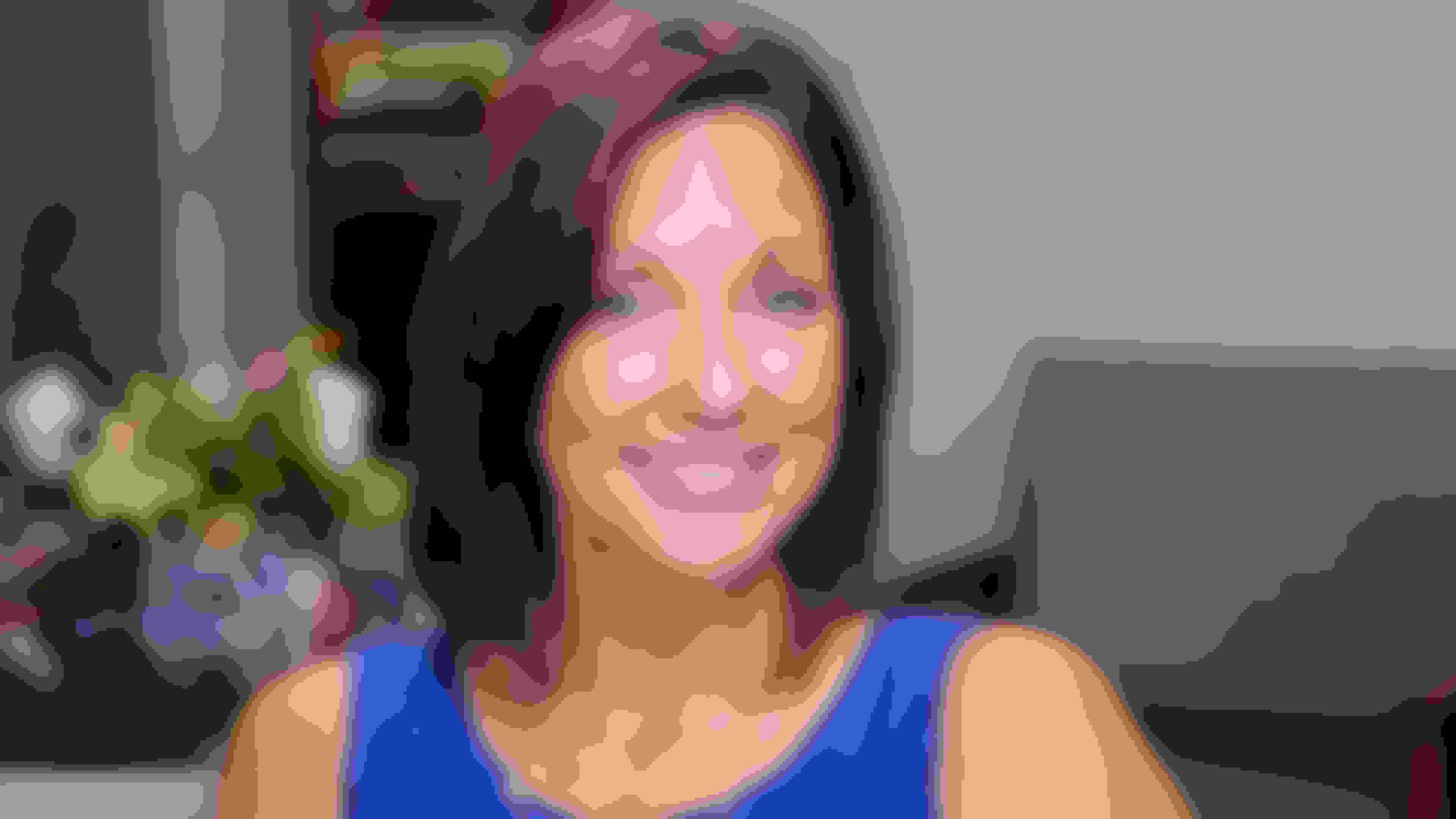 Ana Maria got dental implants at Oral Surgery Group