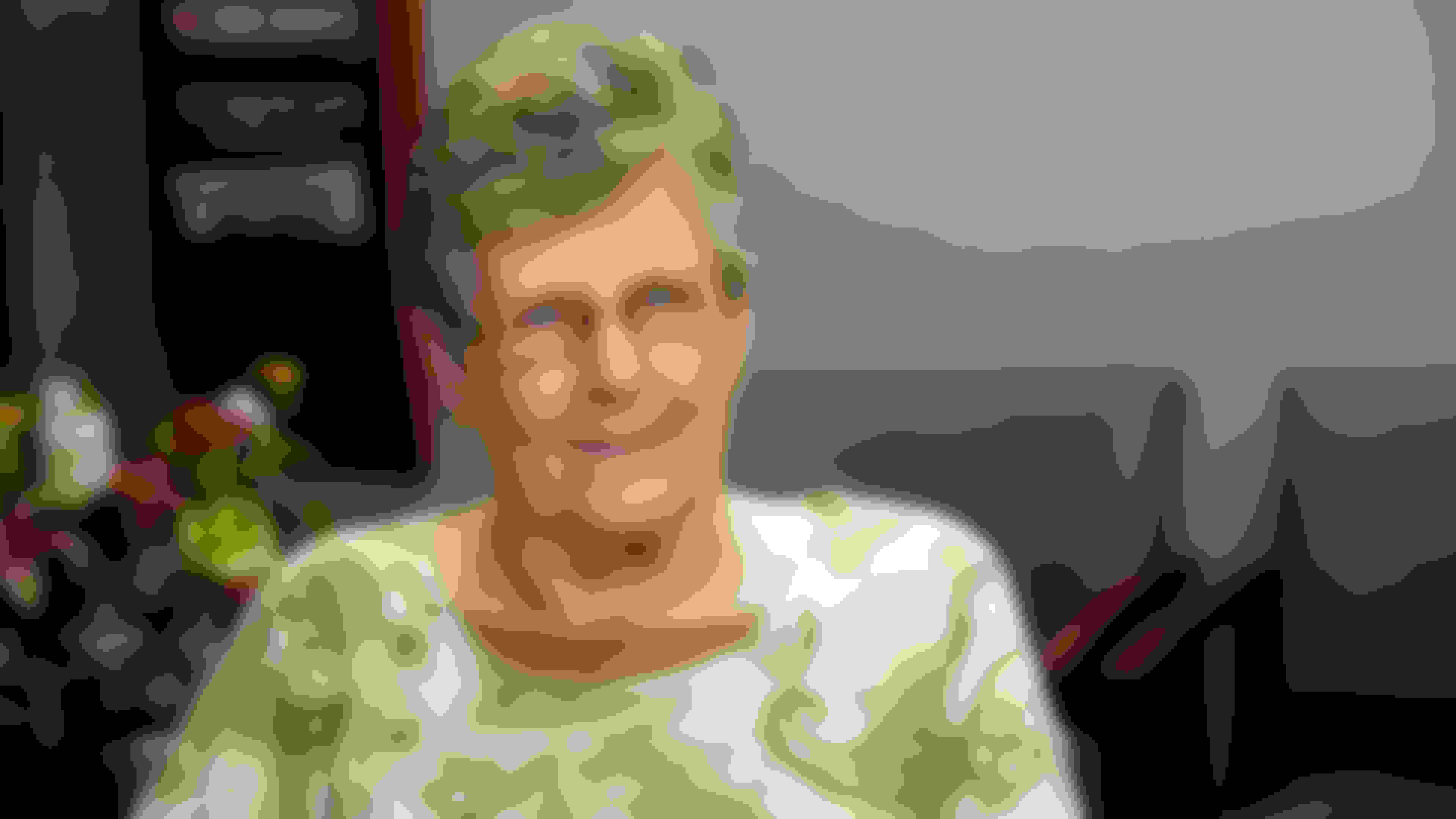 Barbara got dental implants in New Brunswick, NJ