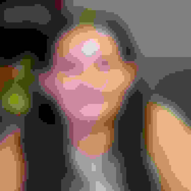 Cali underwent expose and bond treatment in New Brunswick, NJ