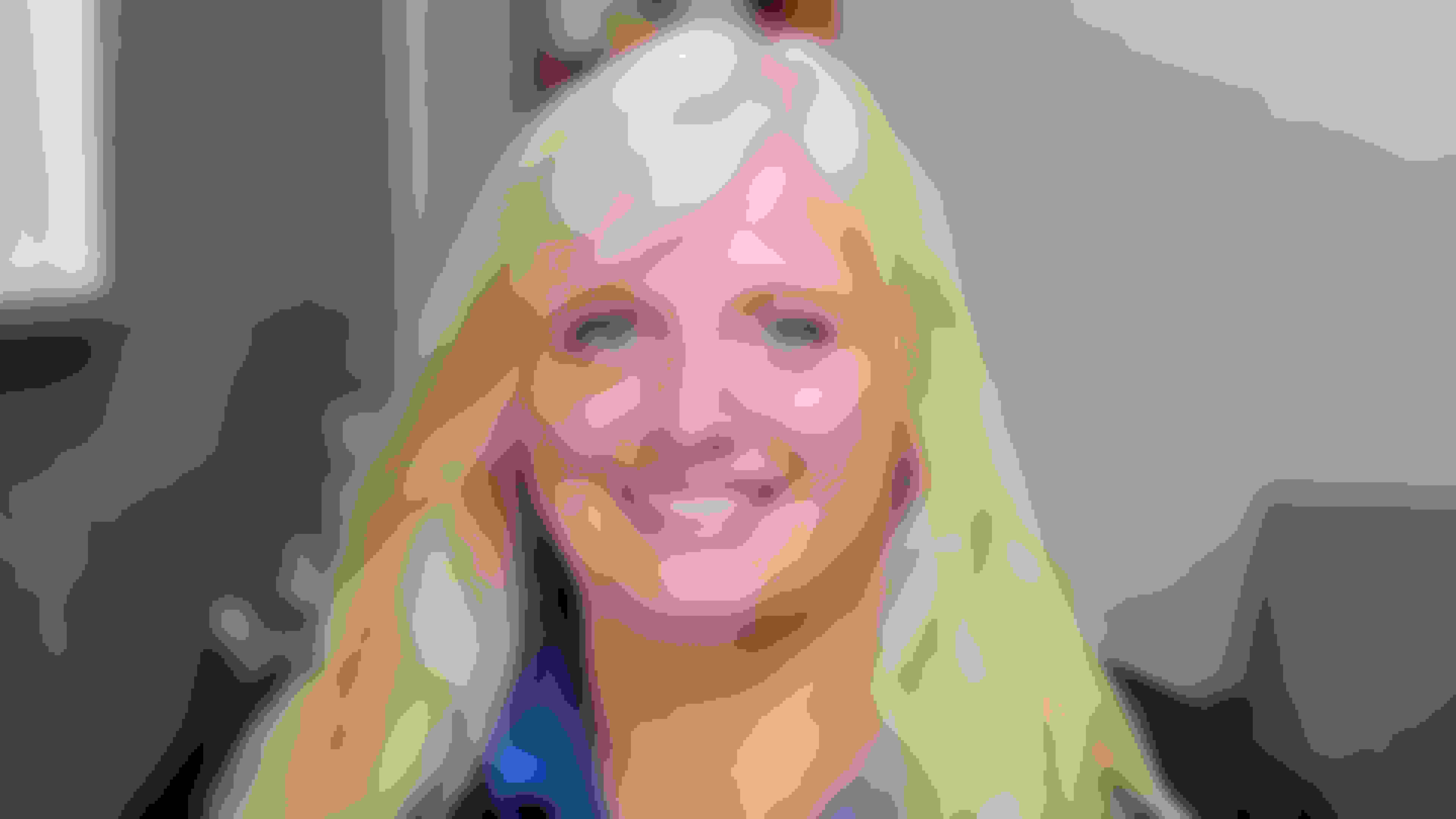 Debbie had oral surgery at Oral Surgery Group