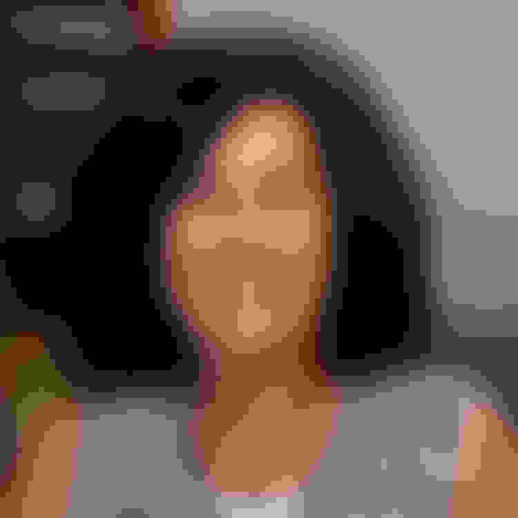 Ellen had a dental implant placed in New Brunswick, NJ