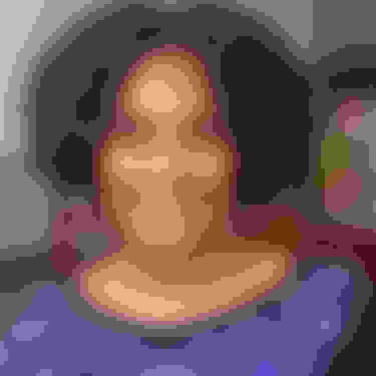 Jaqueline got a dental implant in East Brunswick, NJ