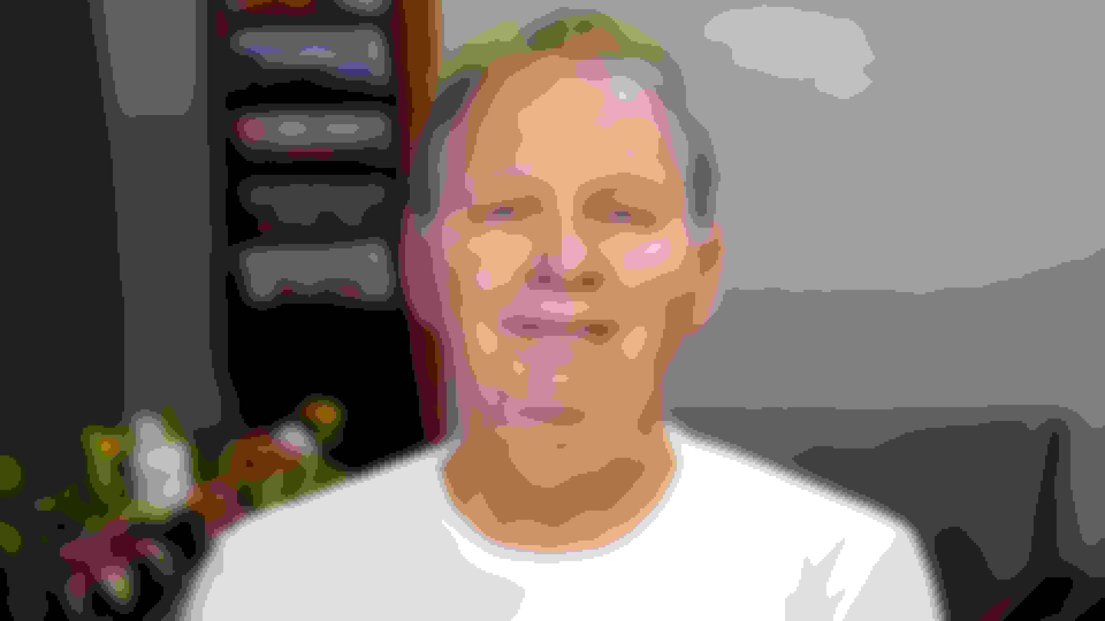 Ken had oral surgery at Oral Surgery Group