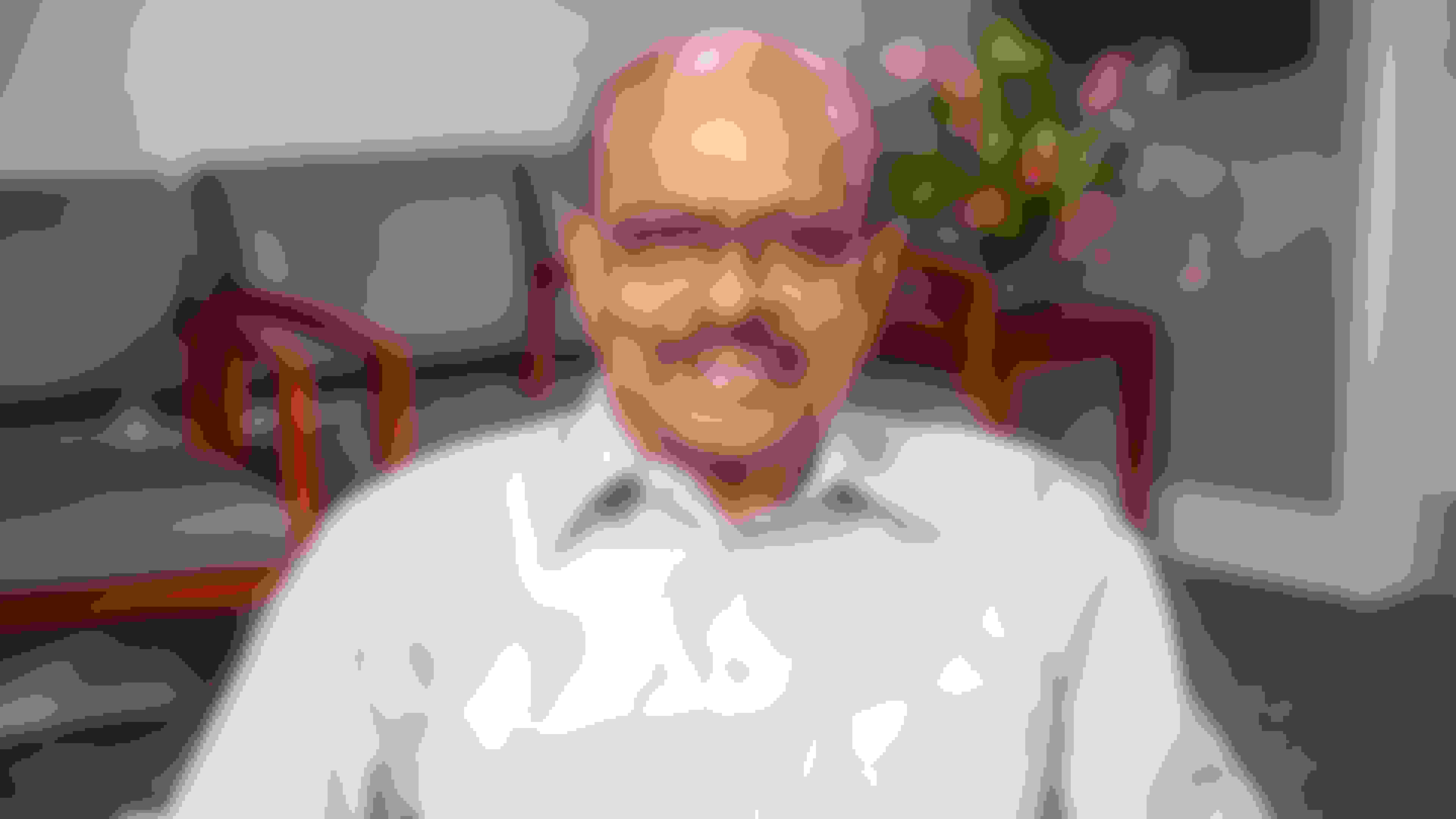 Kirit got a dental implant in East Brunswick, NJ