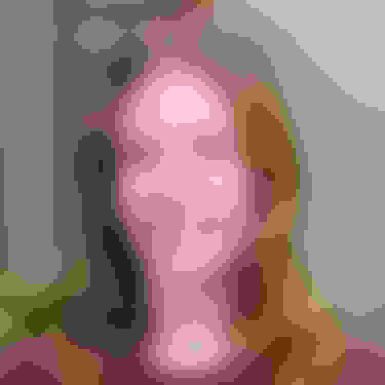 Linda had oral surgery at Oral Surgery Group