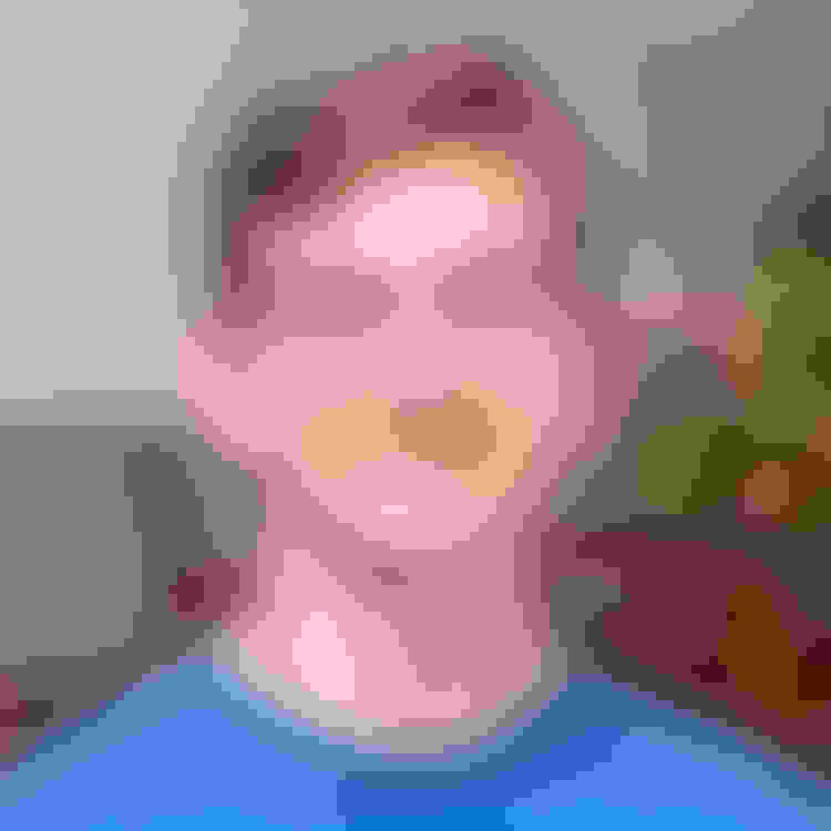 Richard had oral surgery at Oral Surgery Group