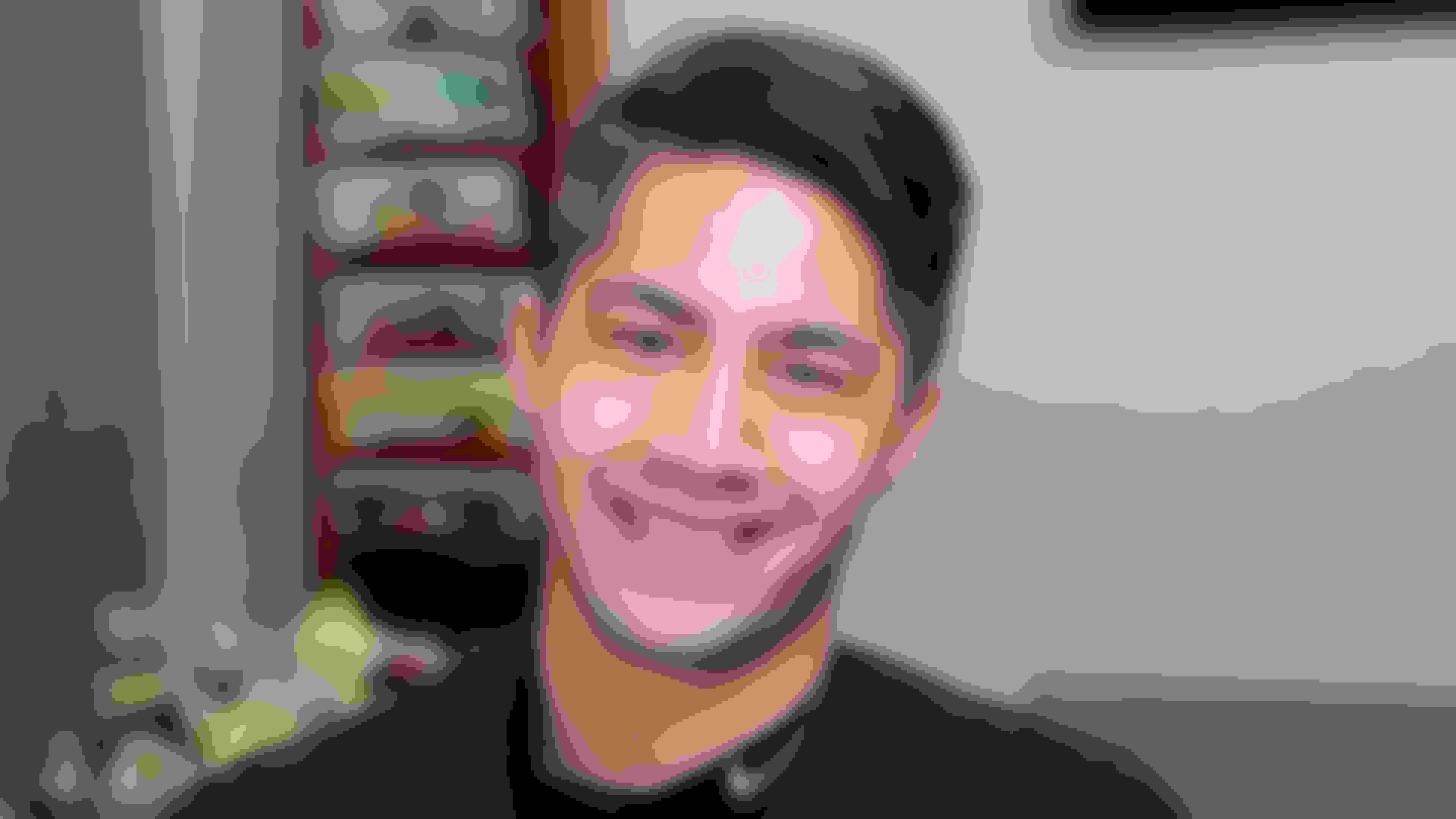 Rob had oral surgery at Oral Surgery Group