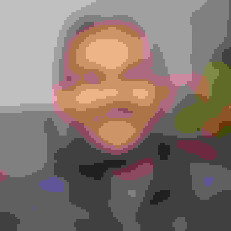 Shyam had an apicoectomy in Middlesex, NJ