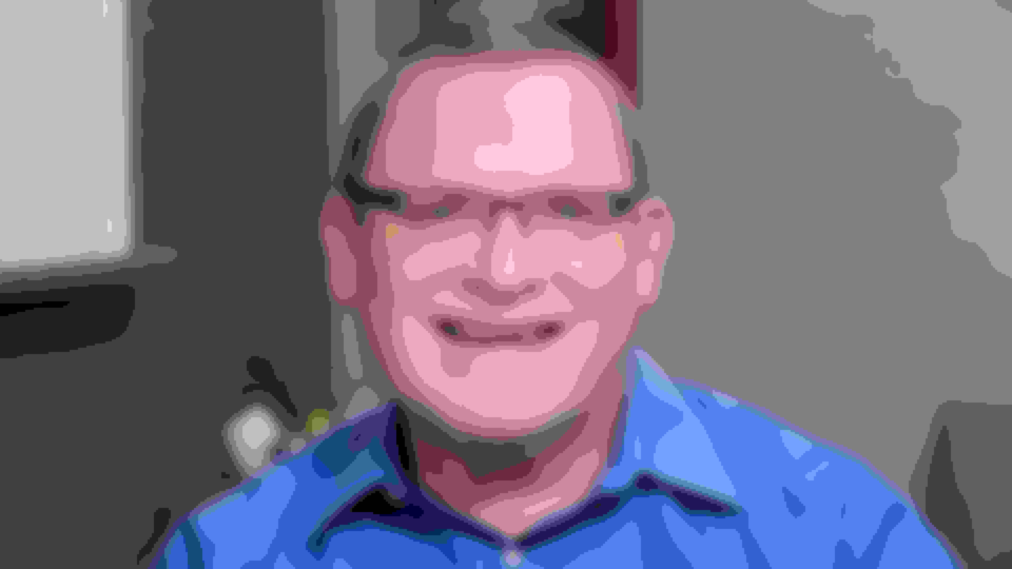 Steve had oral surgery at Oral Surgery Group