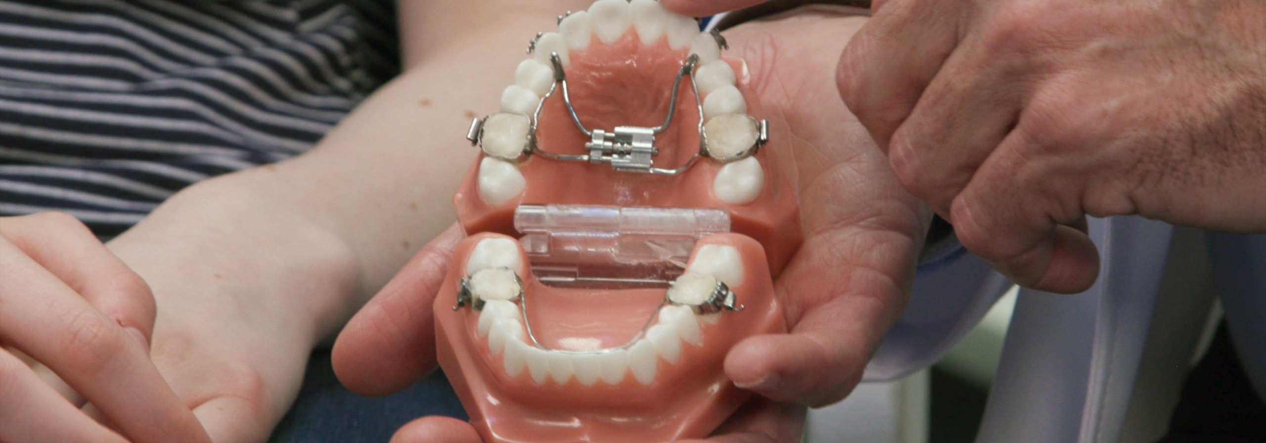 Why choose an orthodontist specialist?
