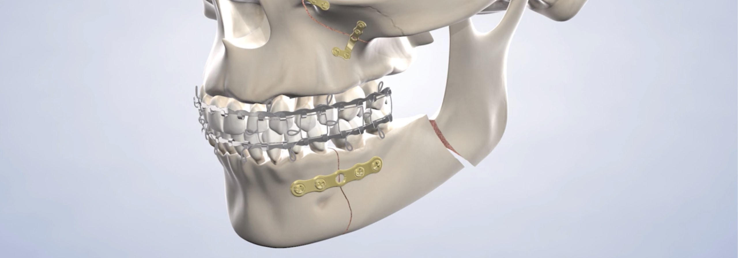 Facial trauma treatment in Dumas, Canyon, Amarillo, Farwell, and Dalhart, TX