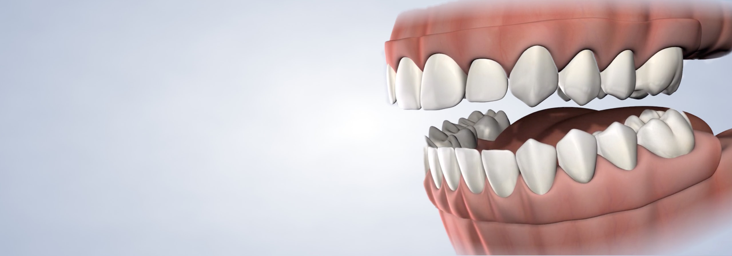 Pre-prosthetic surgery Dumas, Canyon, Amarillo, Farwell, and Dalhart, TX