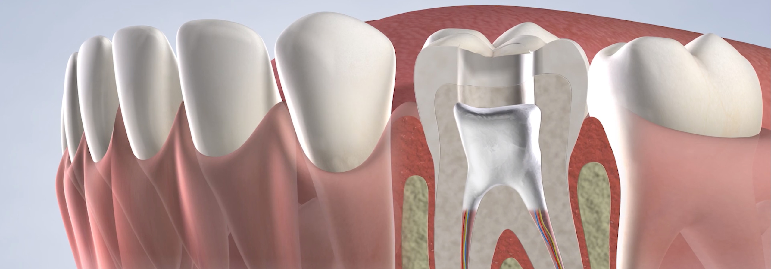 Root canal in Dumas, Canyon, Amarillo, Farwell, and Dalhart, TX