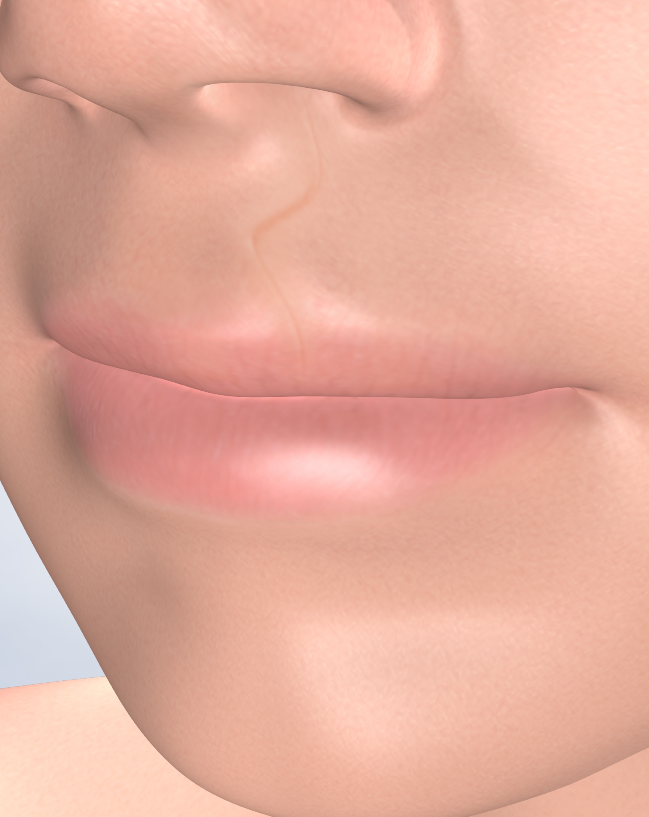 Cleft lip and palate repair in Dumas, Canyon, Amarillo, Farwell, and Dalhart, TX