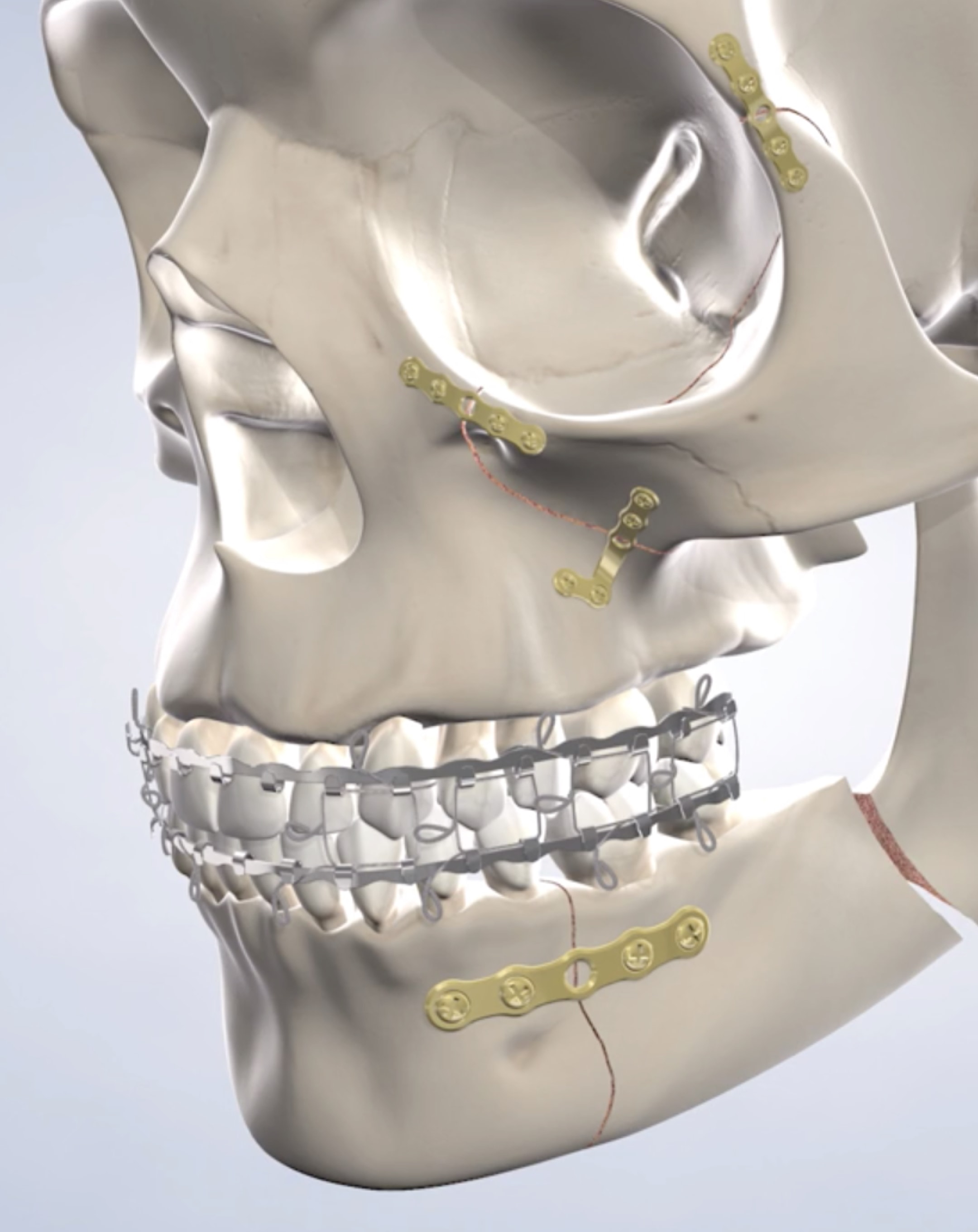 Facial trauma treatment in Dumas, Canyon, Amarillo, Farwell, and Dalhart, TX