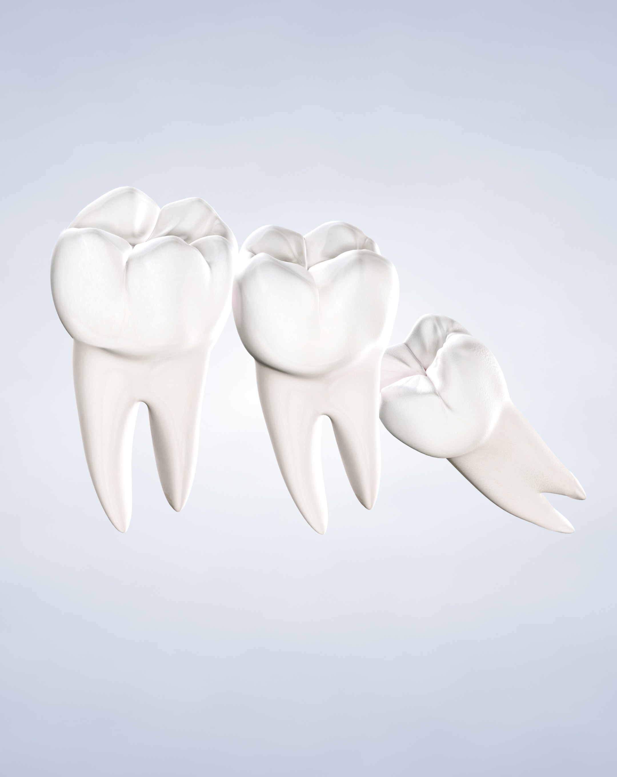 Wisdom teeth removal in Dumas, Canyon, Amarillo, Farwell, and Dalhart, TX