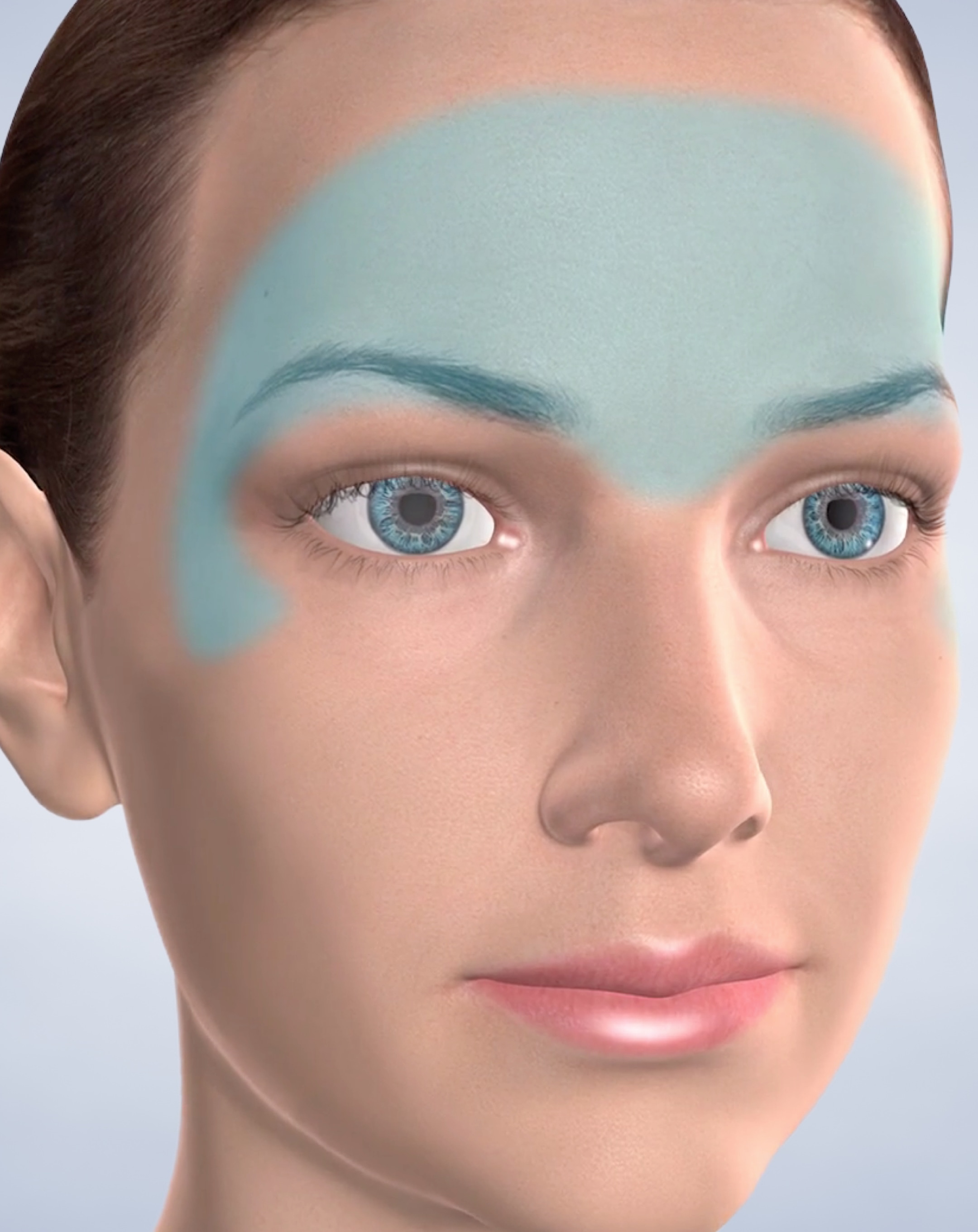 Facial Fillers in Silverdale, Poulsbo, & Port Orchard, WA Kitsap Oral