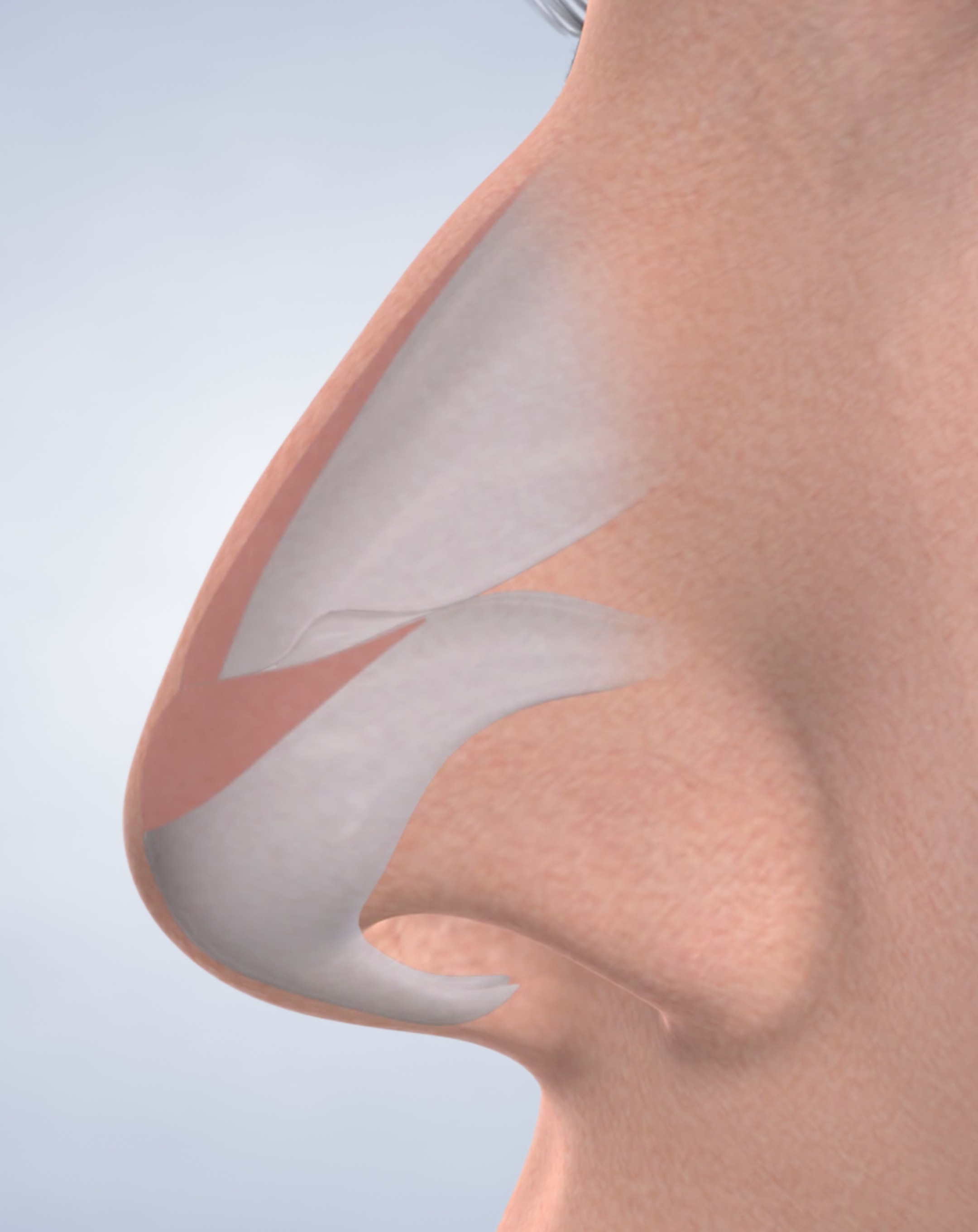 Rhinoplasty in Silverdale, Poulsbo, & Port Orchard, WA Kitsap Oral