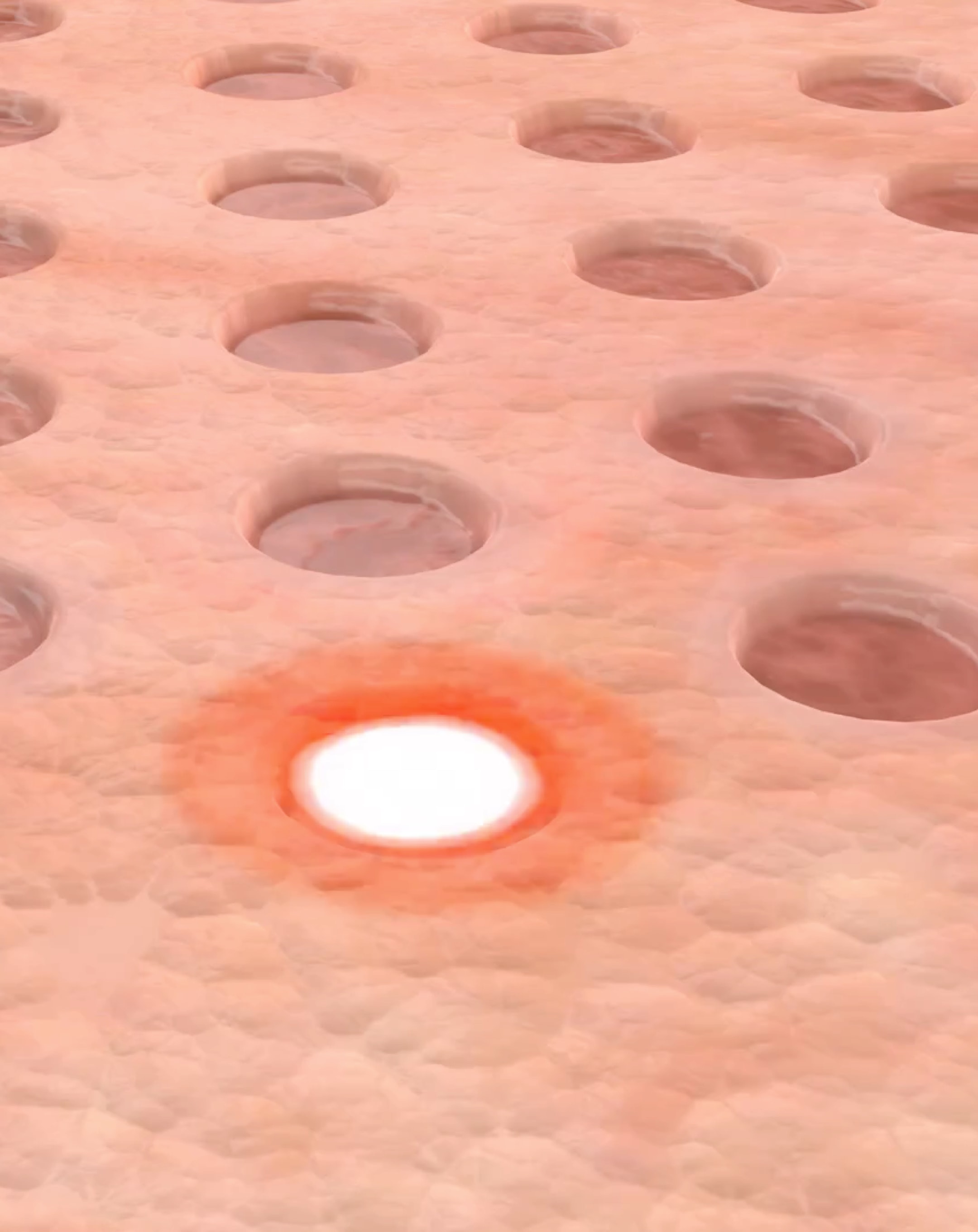 Facial Resurfacing in Silverdale, Poulsbo, & Port Orchard, WA Kitsap