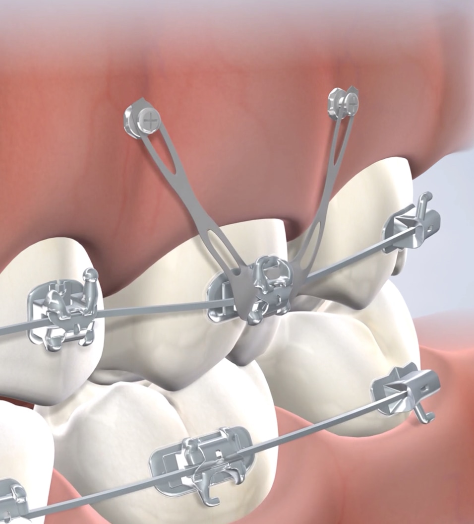 Anchord device procedure query page