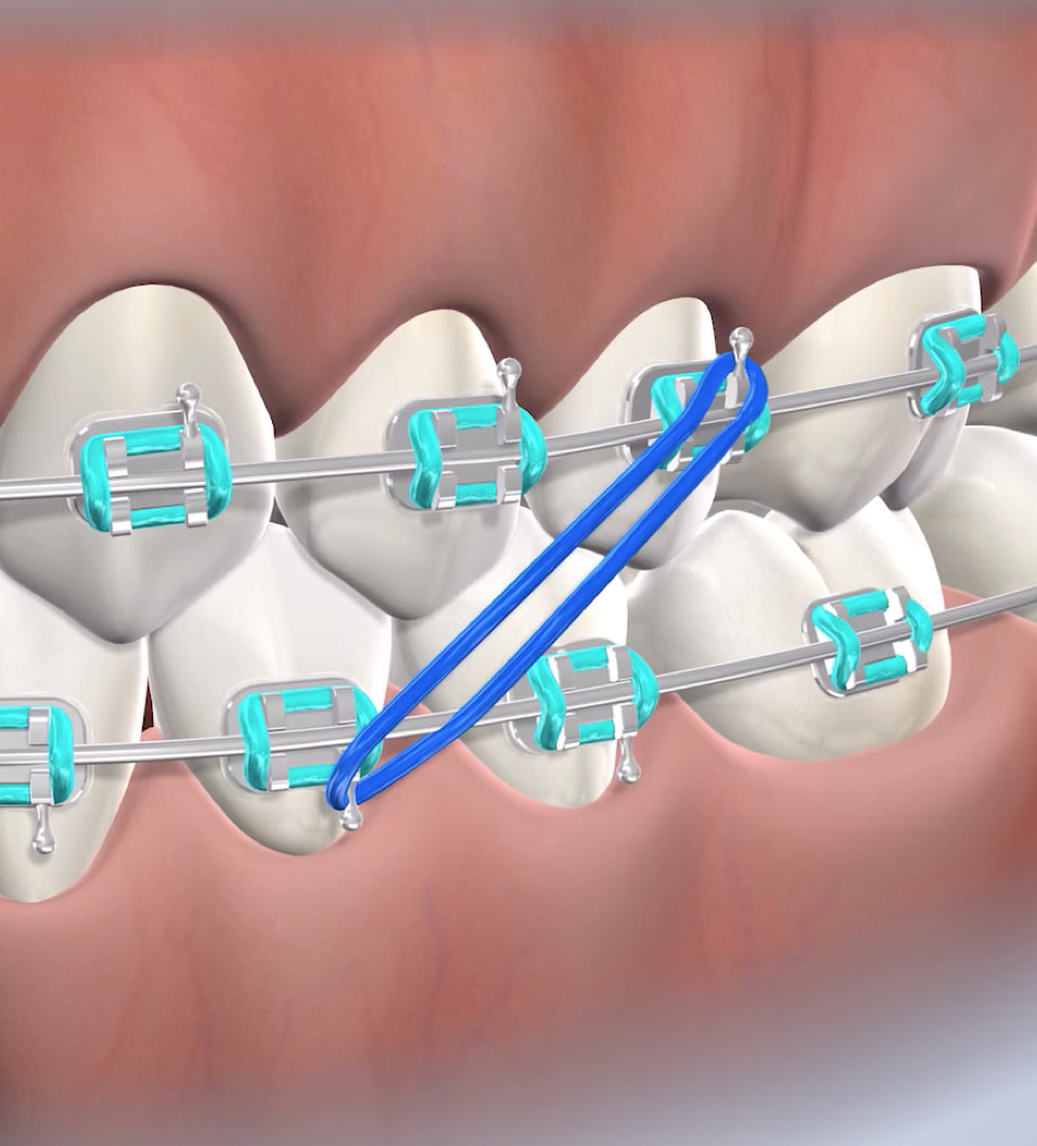 Bite correction procedure query page