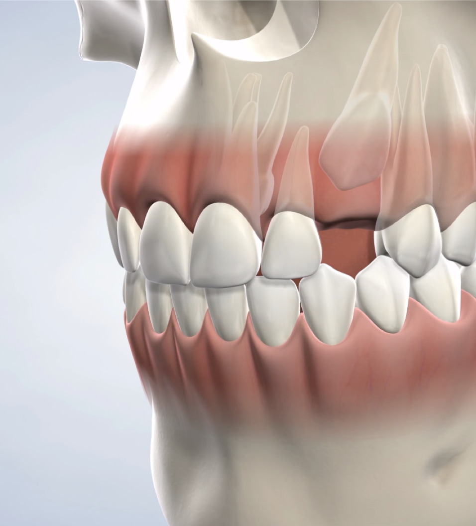 Emergency orthodontics query page