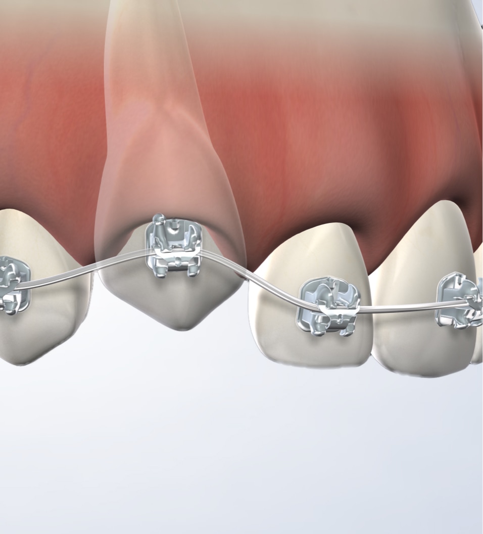 Expose and bond procedure query page