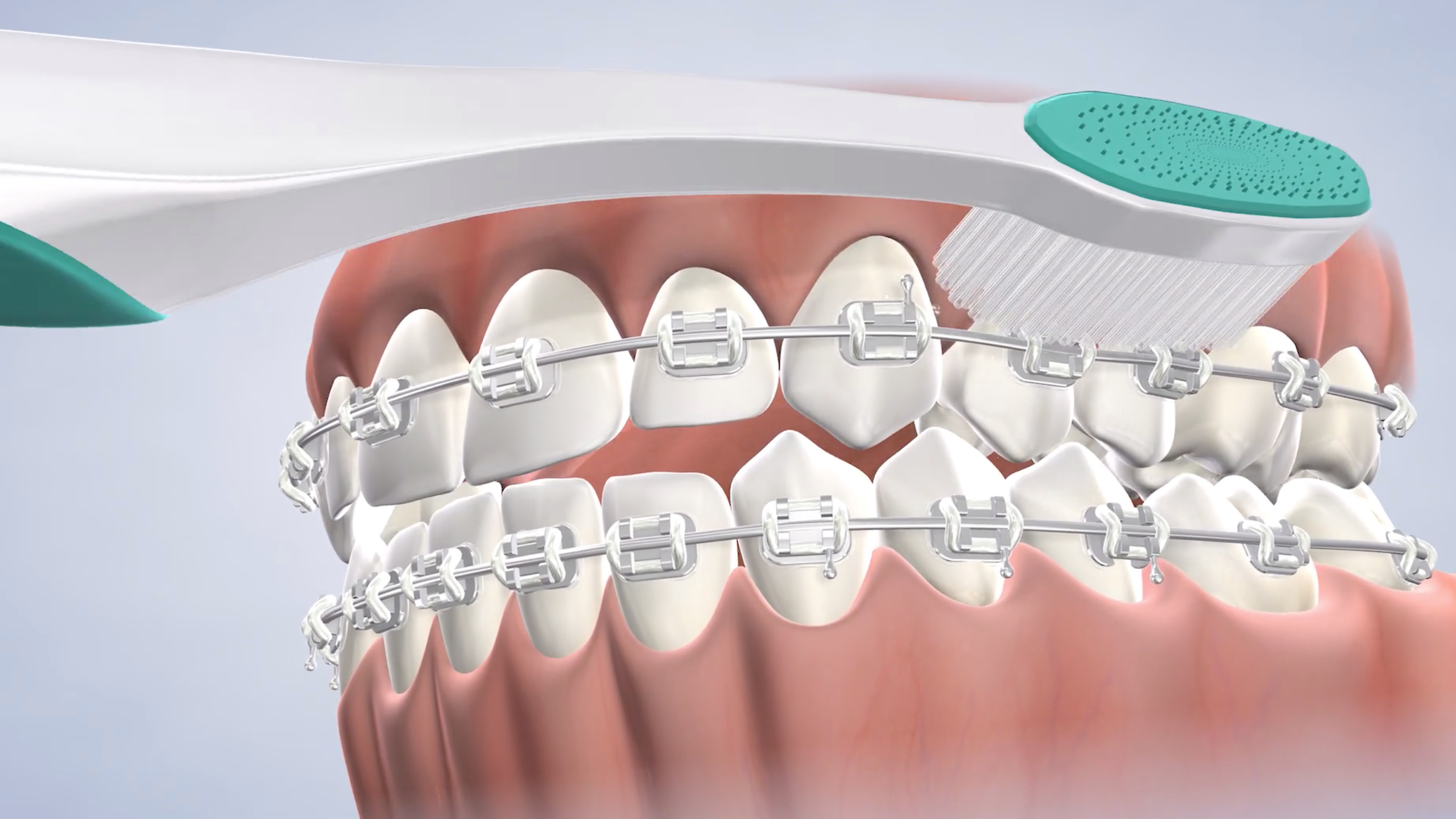 Oral hygiene instructions