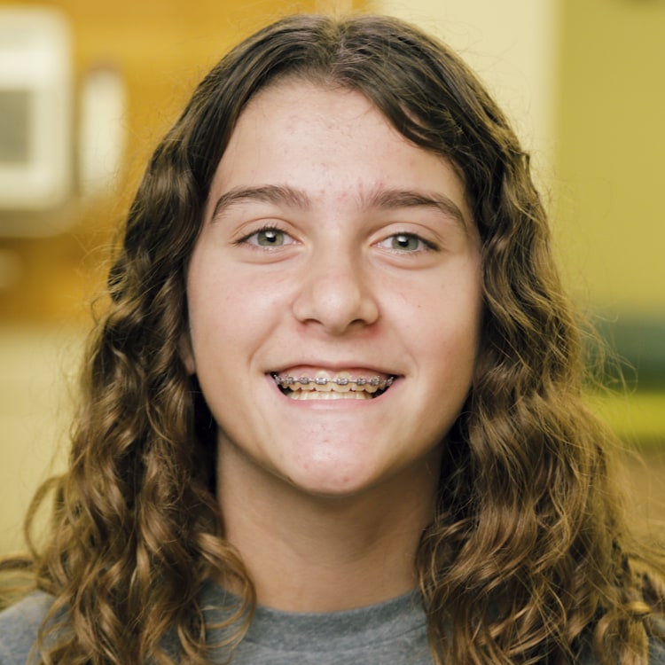 Testimonial jaden 2018 braces facewall