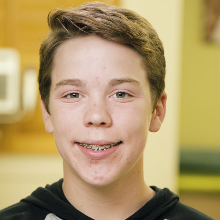 Tyler got braces in Clovis, CA