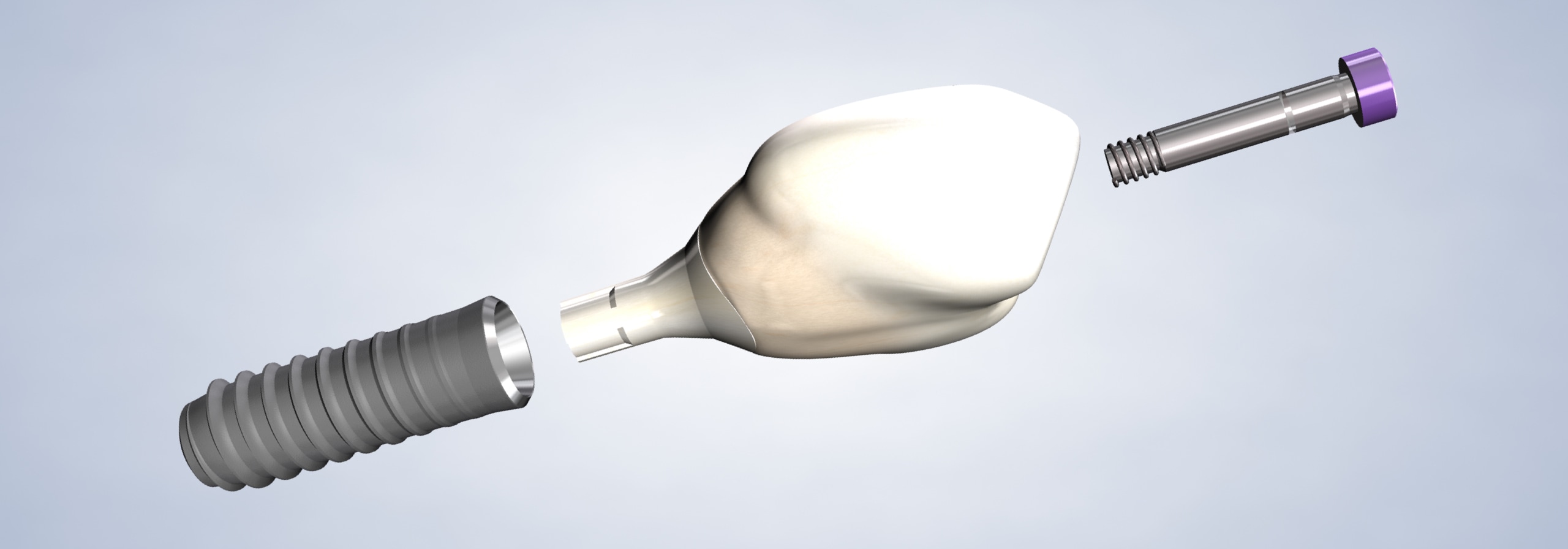 Dental Implants in Reno, NV