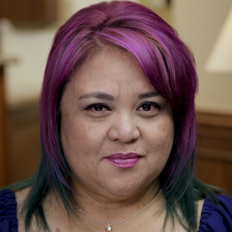 Jessilyn got dental implants in Auburn, WA