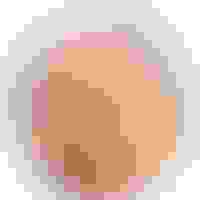 Cyndi di biopsy testimonial facewall