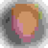 Jane got a dental implant in New Brunswick, NJ