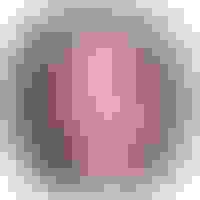 Linda had oral surgery at Oral Surgery Group